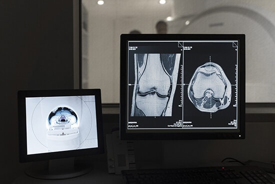 Ct scan bilddatauppsättning