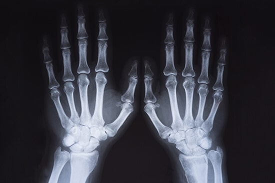 X-Ray Image Dataset