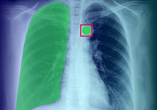 Medical Image Annotation