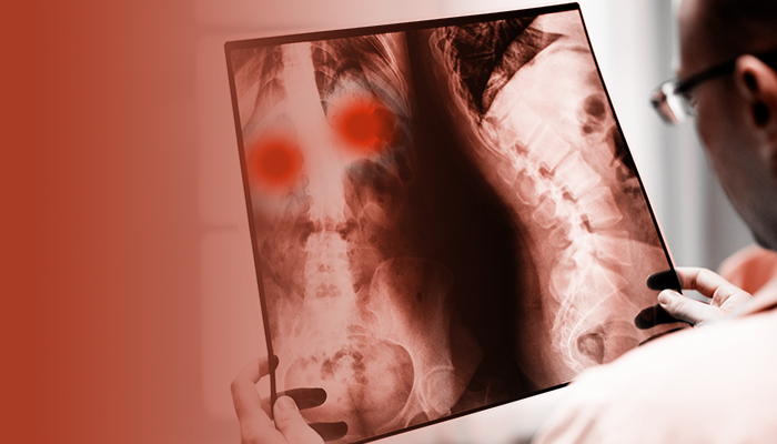 Bộ dữ liệu X-quang