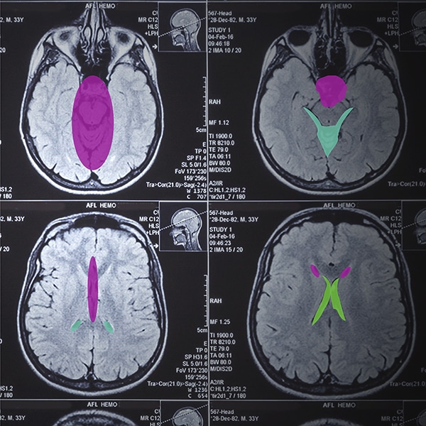 ডিকম ছবির তথ্য