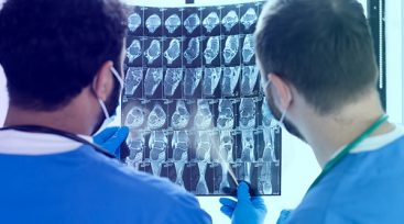 CT-scan CT-scan